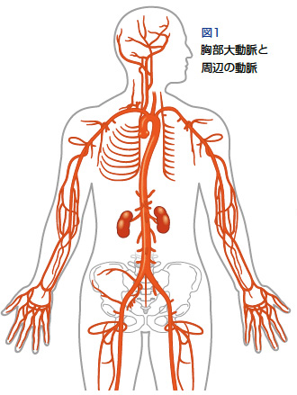 胸部大動脈と周辺の動脈